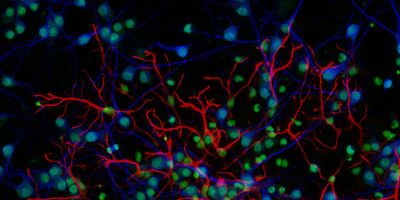  Immunofluorescent analysis of E18 Sprague Dawley dissociated rat cortical neuronal cells (MAP2, blue) mixed with astrocytes (GFAP, red), with nuclei (green) overlay.  Cells were labeled with chicken anti-MAP2, rat anti-GFAP, Alexa Fluor Plus 405 Goat anti-Chicken (1:250), Alexa Fluor Plus 647 Donkey anti-rat (1:500), and Sytox Green. Imaged on an EVOS M7000 Imaging system.